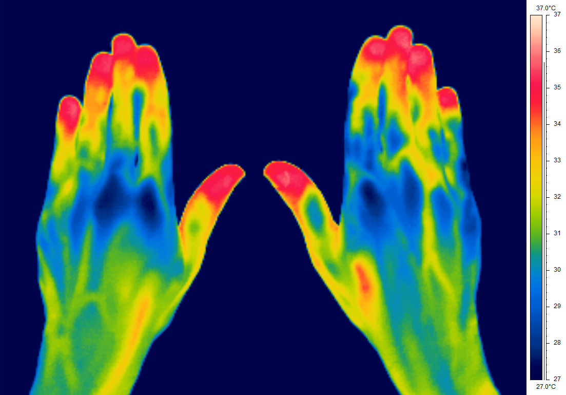 Anova Technology Thermography